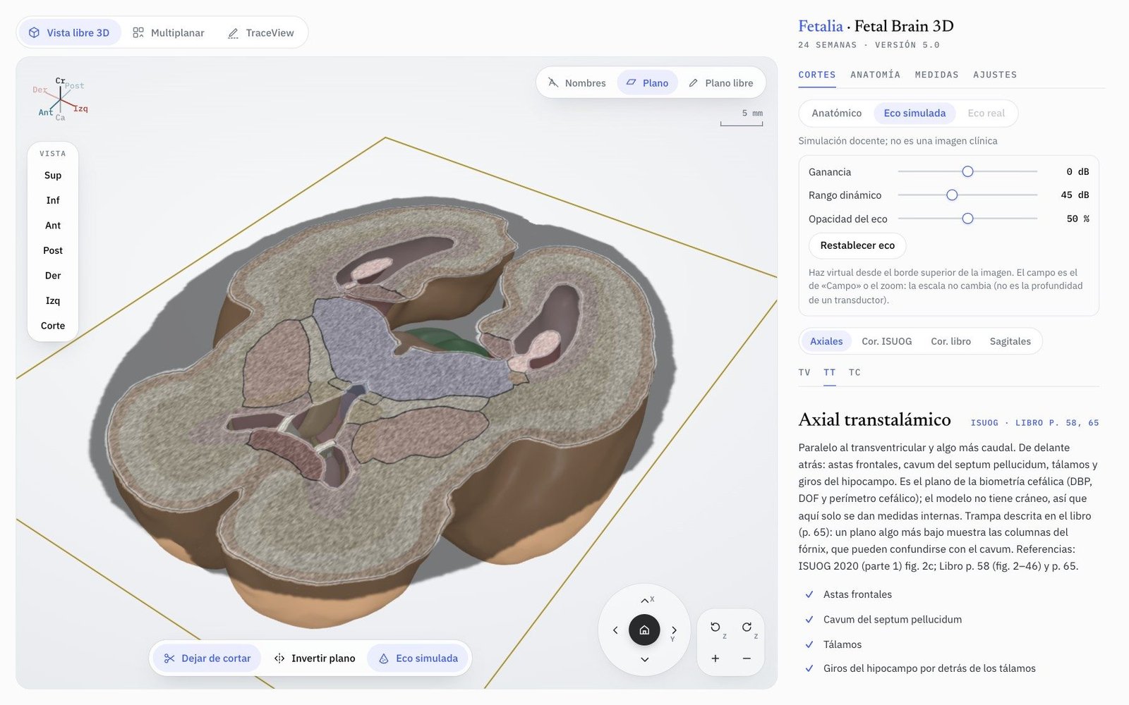 Fetal Brain 3D en Vista libre: corte axial transtalámico en aspecto realista con la eco simulada al 50 %
