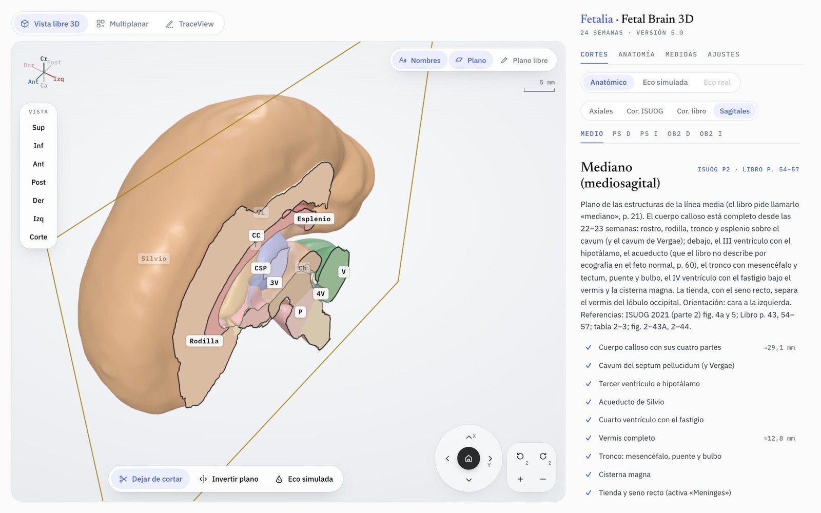 Fetal Brain 3D en Vista libre: el cerebro cortado por el plano mediano, con los nombres de las estructuras