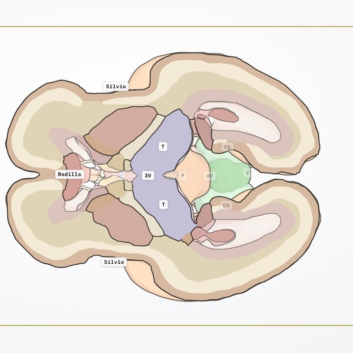 Corte axial transtalámico del modelo con las estructuras coloreadas y rotuladas