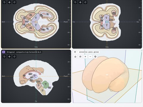 Multiplanar del cerebro
