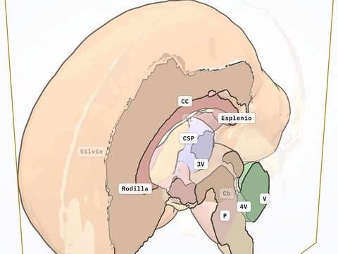 Corte sagital medio con el cuerpo calloso