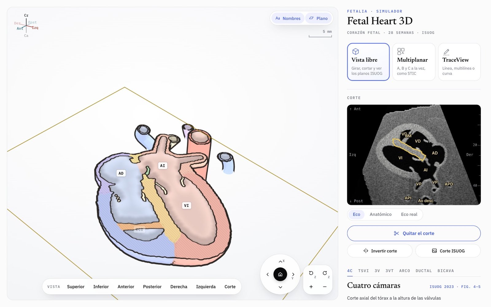 Fetal Heart 3D en Vista libre: el corazón cortado en cuatro cámaras junto a la imagen ecográfica del corte