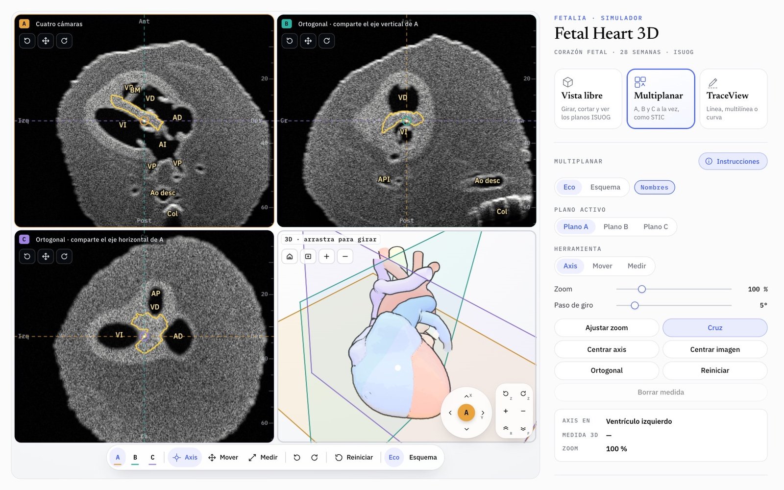 Modo Multiplanar de Fetal Heart 3D: planos A, B y C y la vista 3D con los tres planos