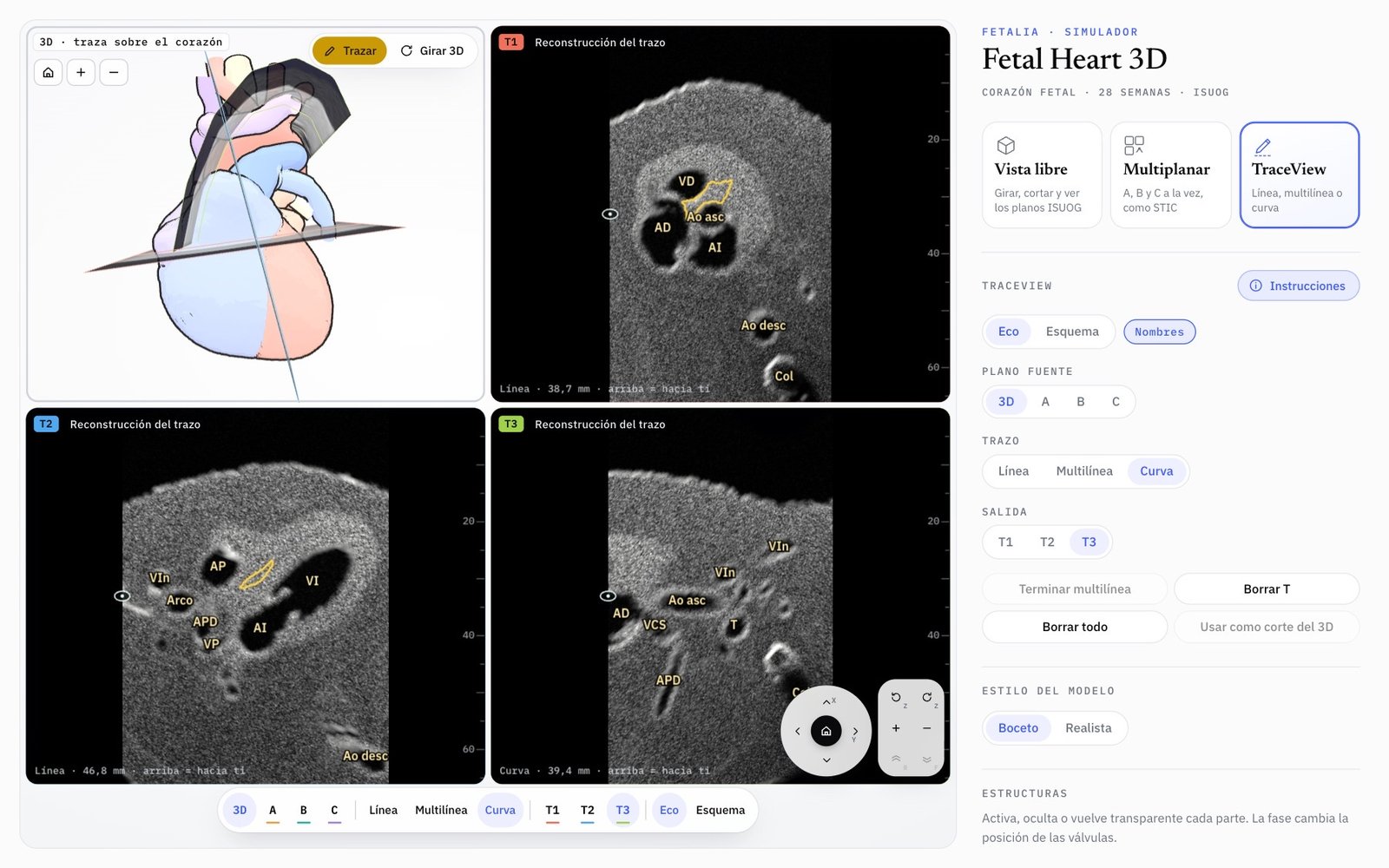 Modo TraceView de Fetal Heart 3D: tres trazos sobre el corazón 3D y sus reconstrucciones T1, T2 y T3