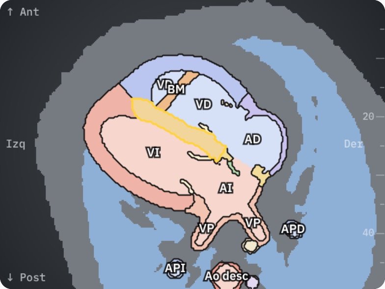 Cuatro cámaras en el esquema anatómico de Fetal Heart 3D