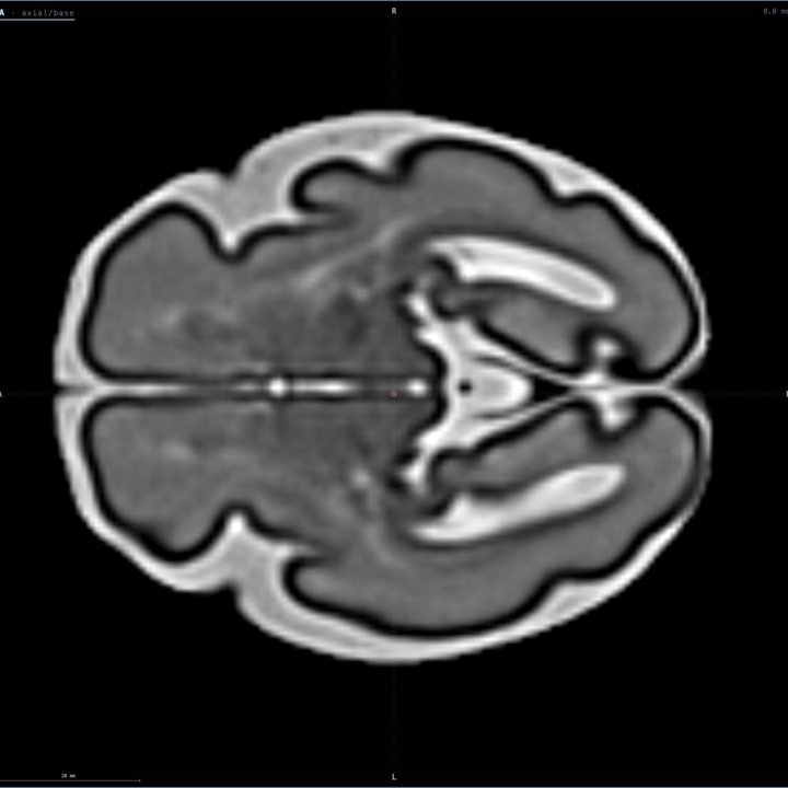 Capa MRI · T2 a las 30 semanas en Fetalia NeuroAtlas