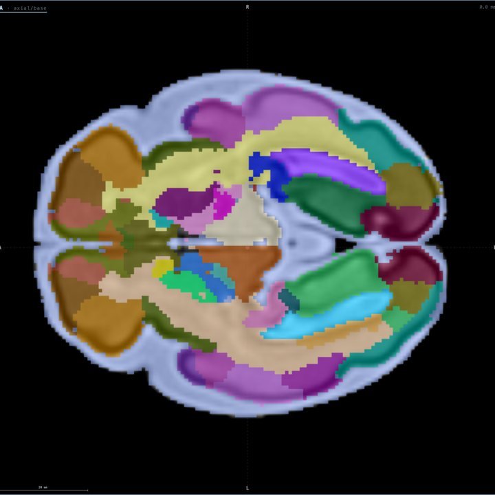 Capa Regiones a las 30 semanas en Fetalia NeuroAtlas