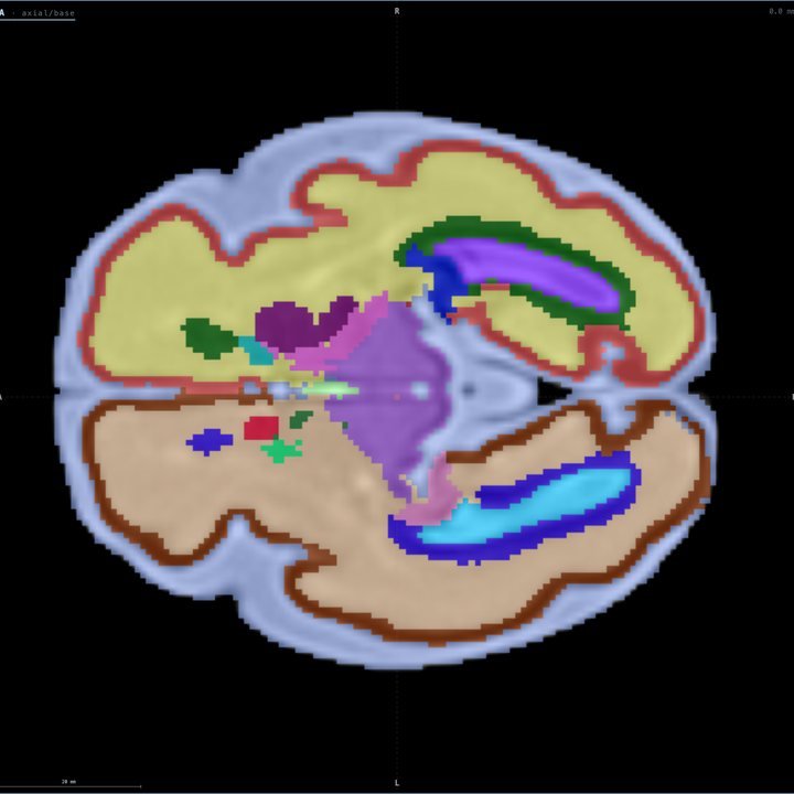 Capa Tejidos a las 30 semanas en Fetalia NeuroAtlas