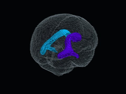 Ventrículos laterales dentro del cerebro translúcido