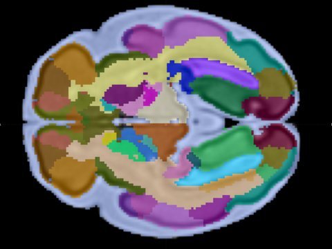 Capa de regiones sobre el corte axial