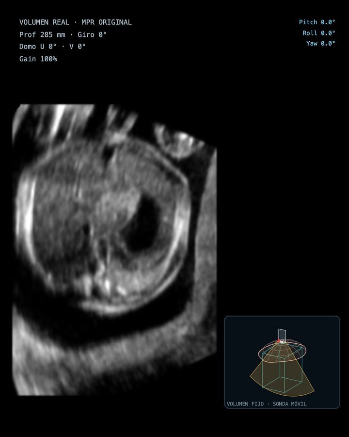 Volumen FVOL de tórax y abdomen