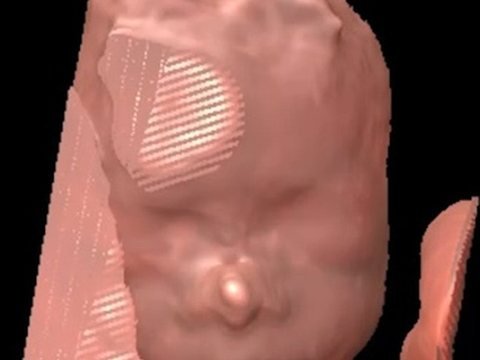 Render de superficie de la cara fetal